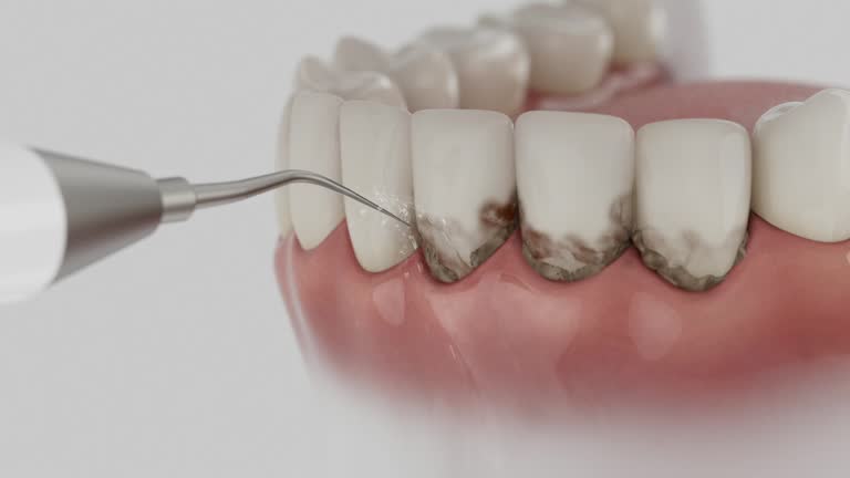 Trusted Emergency Dentist service in Linglestown, PA - Dentist Open Now